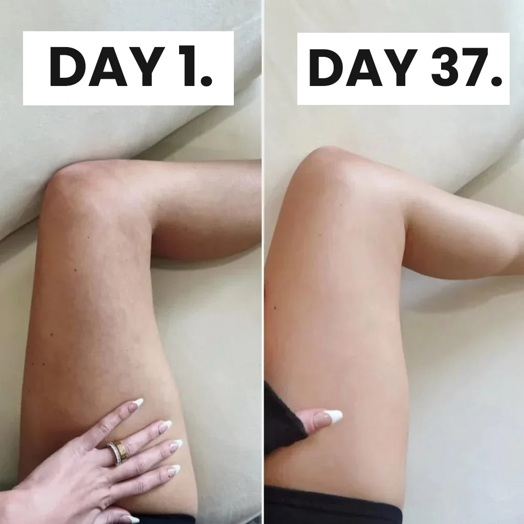 GlowTone™ Anti-Cellulite Massager