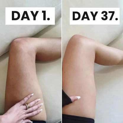 GlowTone™ Anti-Cellulite Massager